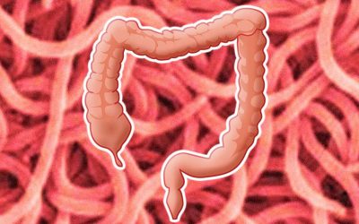 Orsakar bakterien Brachyspira IBS?